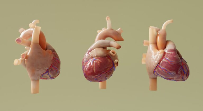 Photo Infarct symptoms