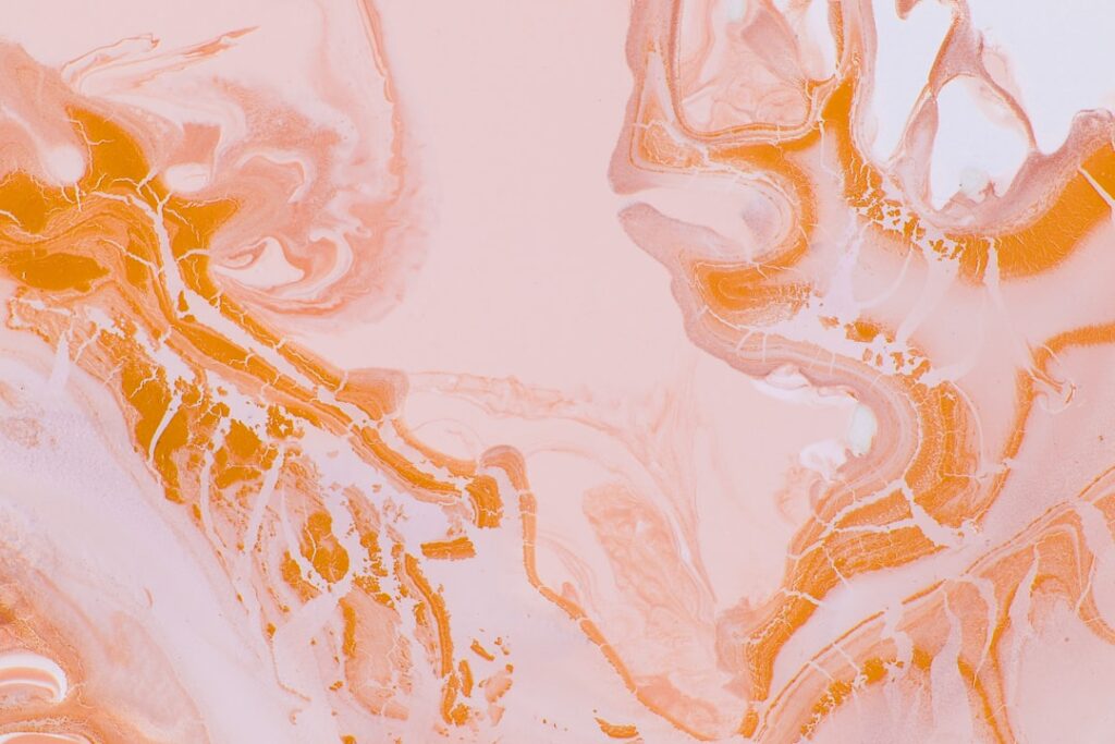 Photo Urinary Infection