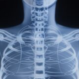 Photo bone health