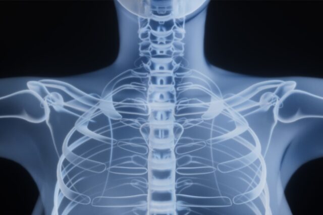 Photo bone health
